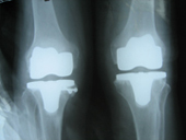 coimbatore-orthopaedic-joint-replacement-maternity-child-welfare-centre-india